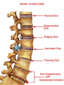 https://nepalpaincarecenter.com/wp-content/uploads/2020/08/backpainpage1-226x300-1.png