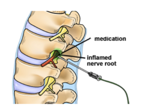 https://nepalpaincarecenter.com/wp-content/uploads/2020/08/backpainpage2-300x224-1.png